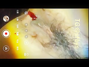 十月最新流出 极品手持厕拍 大神高级会所女厕开着闪光灯高清偷黄裙美女流血的逼